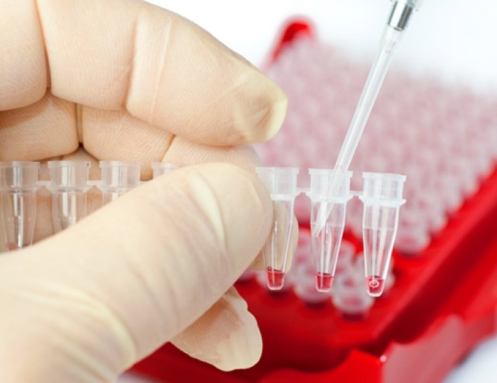 Клиническая лабораторная диагностика - Санаторий «Сосновый Бор» Зудилово